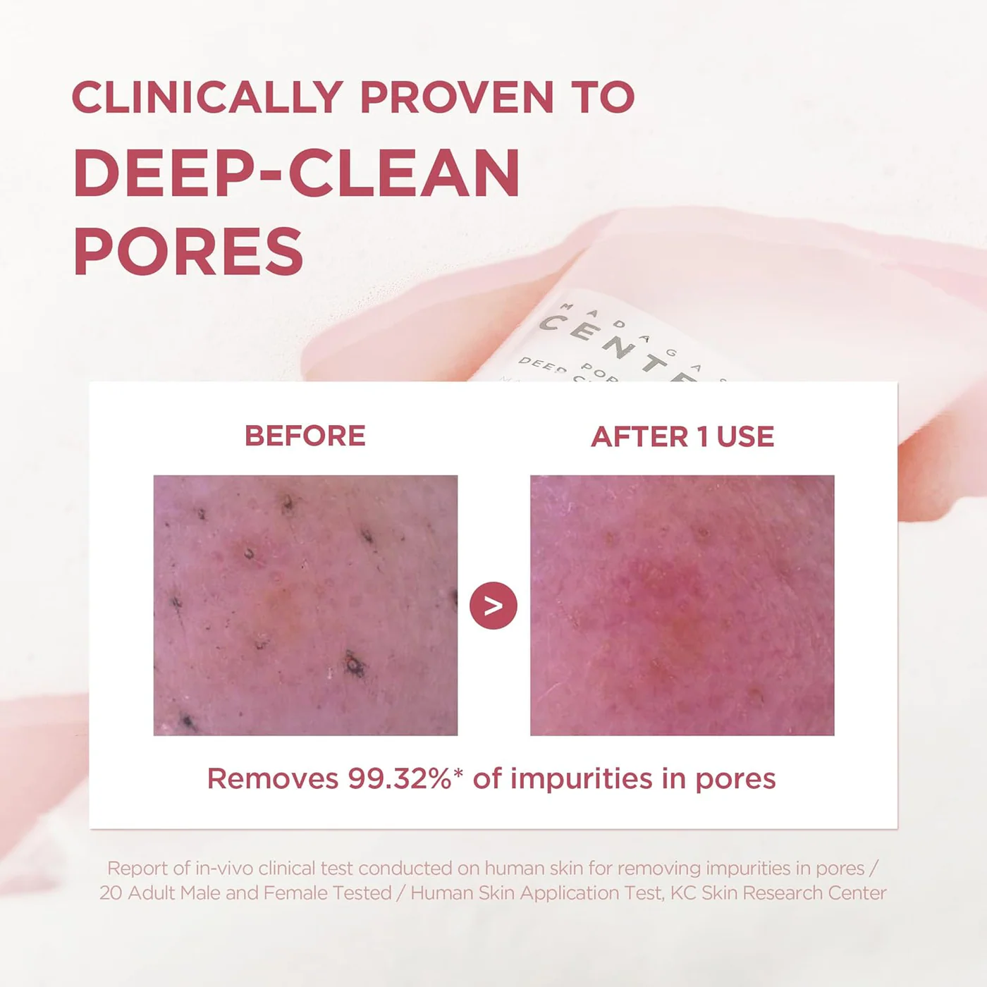 SKIN1004 Madagascar Centella Poremizing Deep Cleansing Foam - Image 7