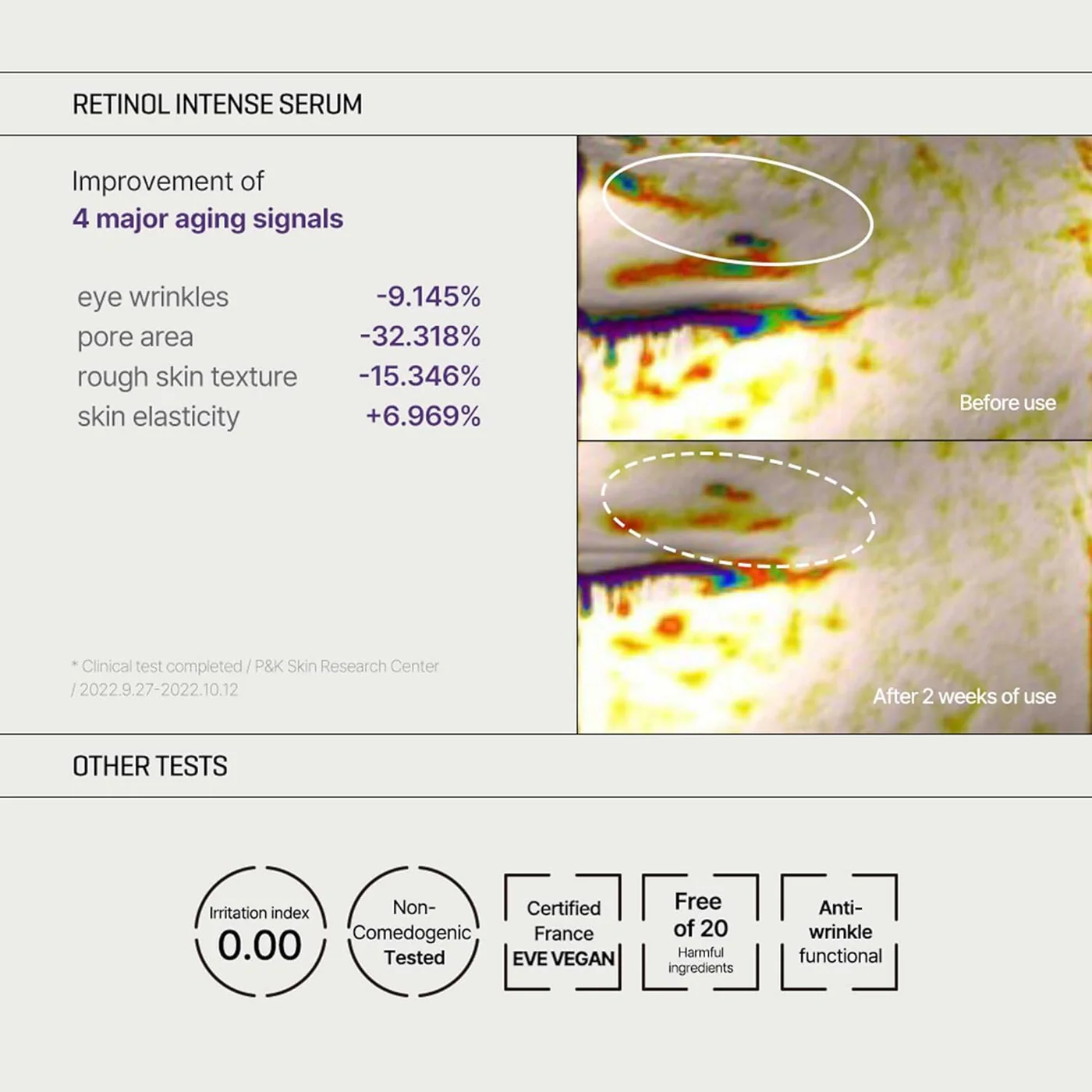 Some By Mi Retinol Intense Trial Kit - Image 6